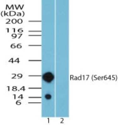 Western Blot: Rad17 [p Ser645] Antibody [NBP2-24457]